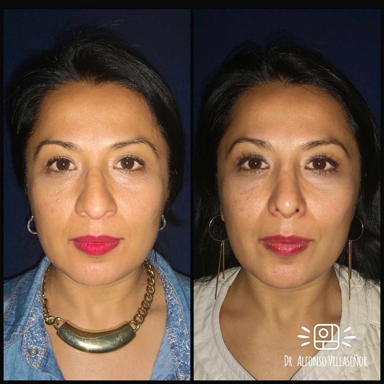 Alfonso Villaseñor Herrero-26