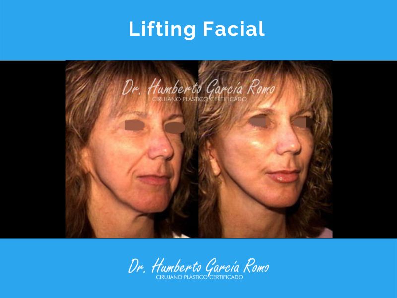 Humberto García Romo-5