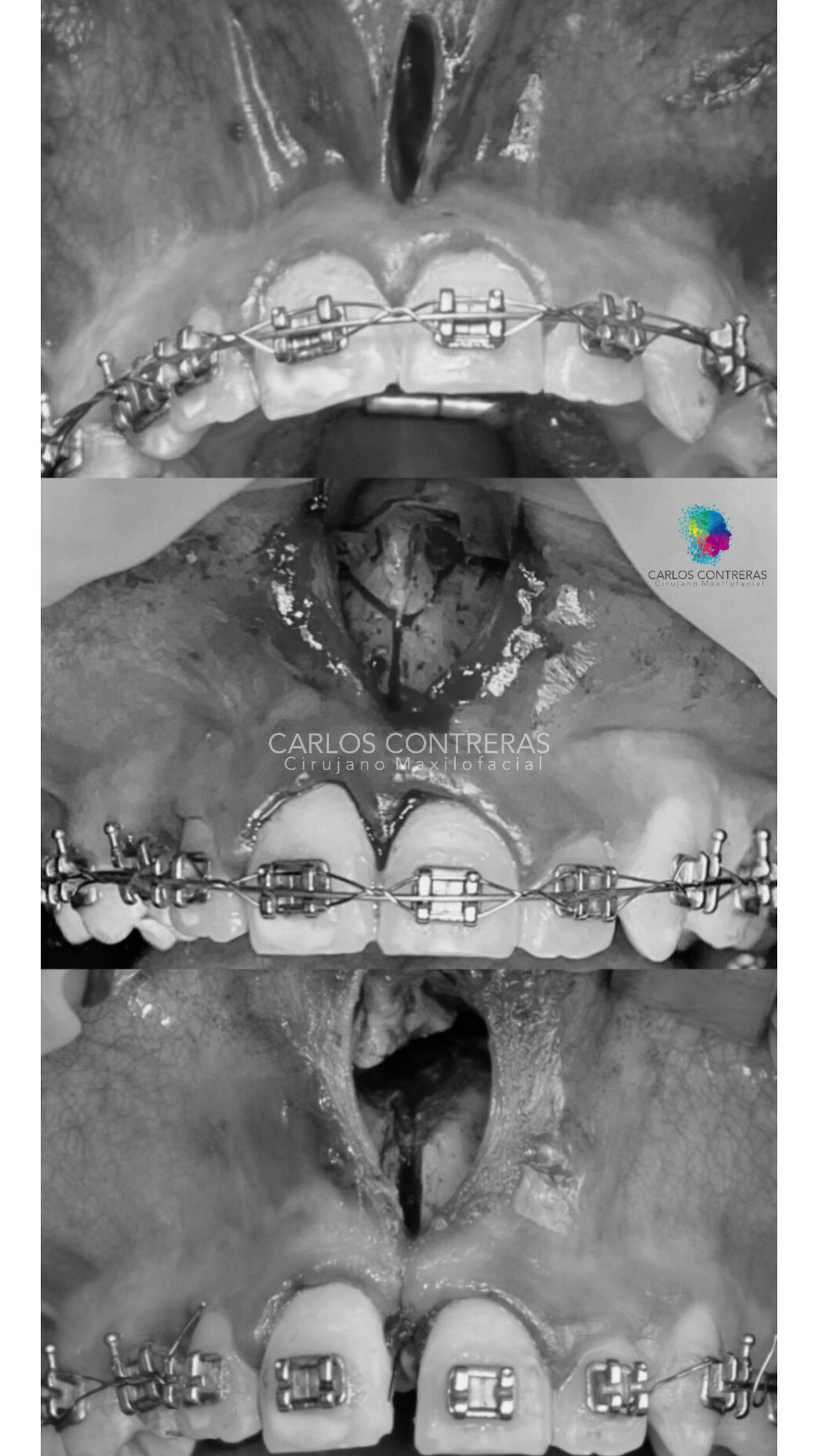 Carlos Ernesto Contreras Castellanos-42
