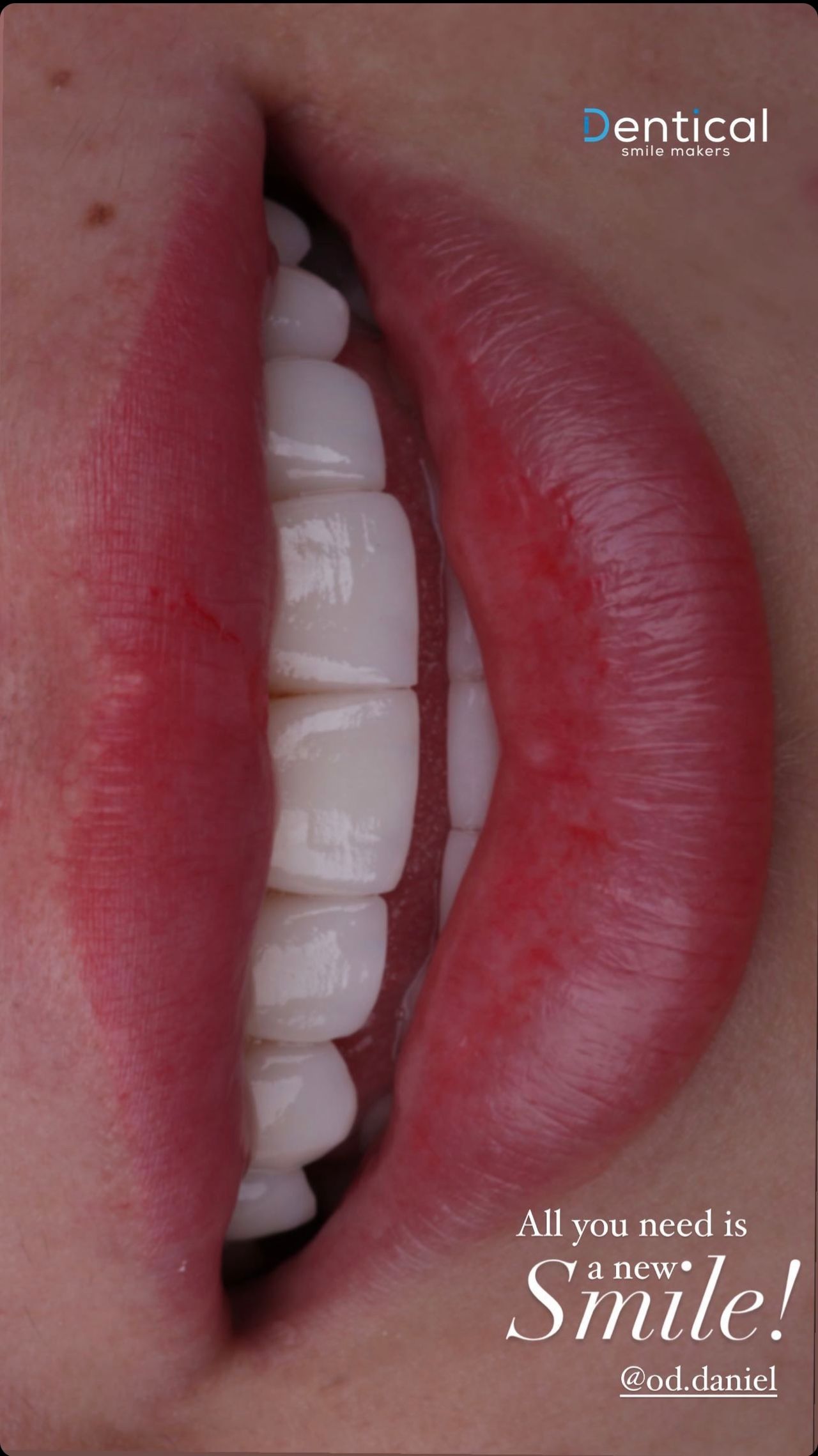 Daniel Perez Parcero-10