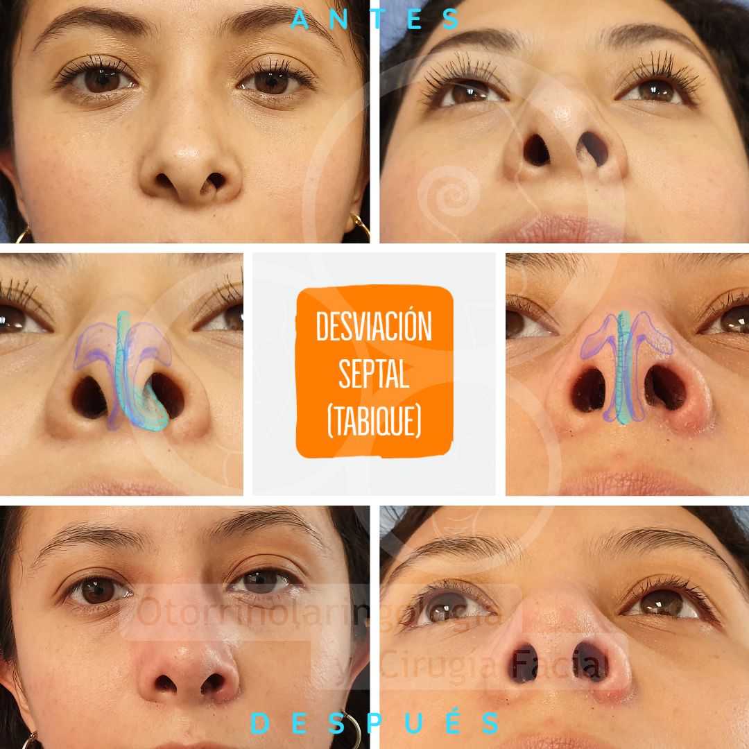 José Christian Ávila Romero-3