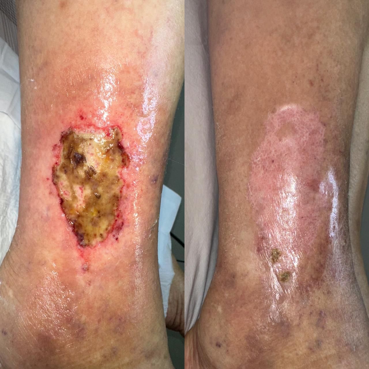 Jhonatan López González-24