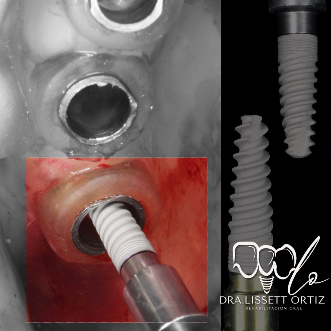 Ana Lissett Ortiz-13