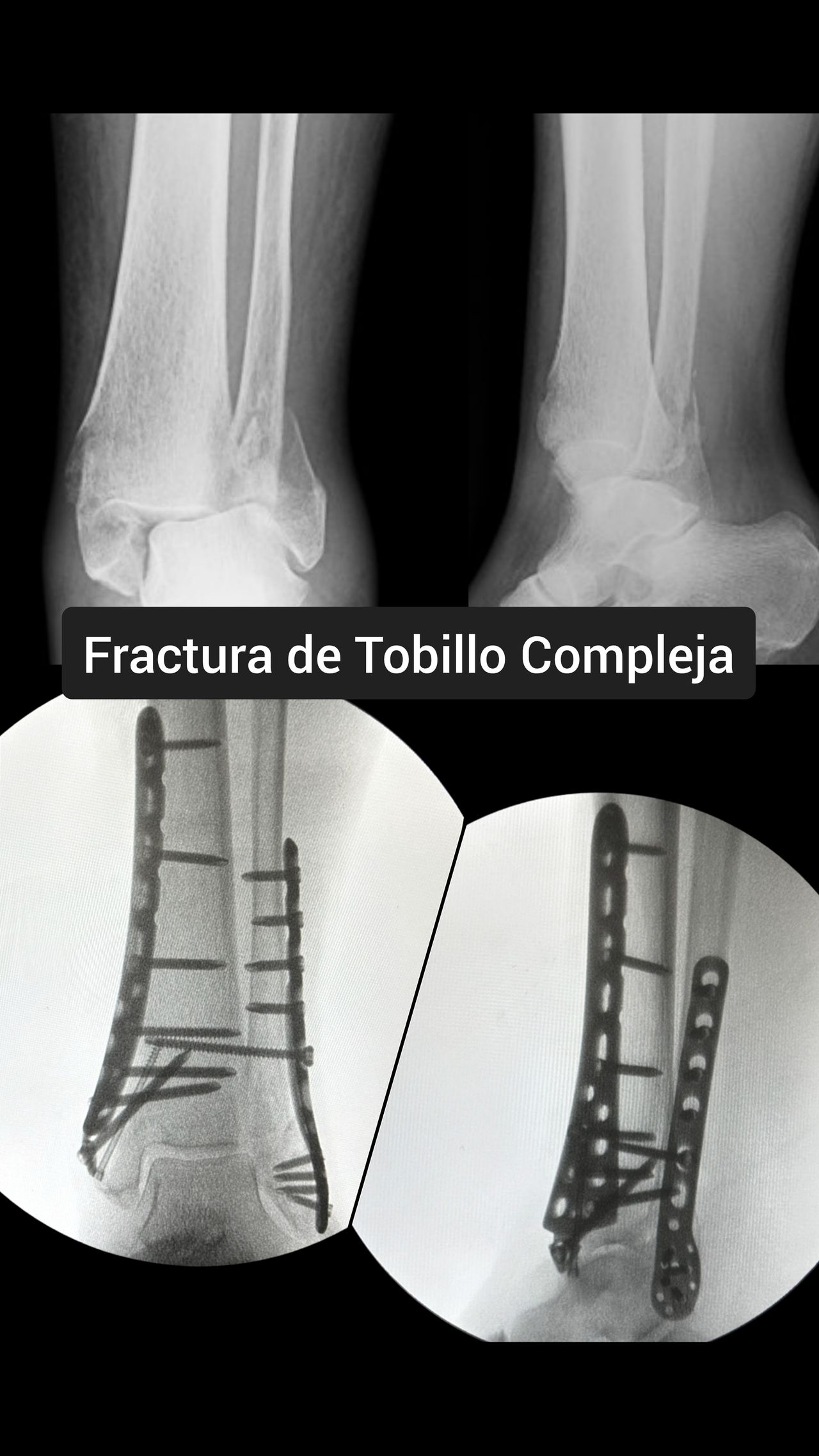 Noé Saavedra Islas-11