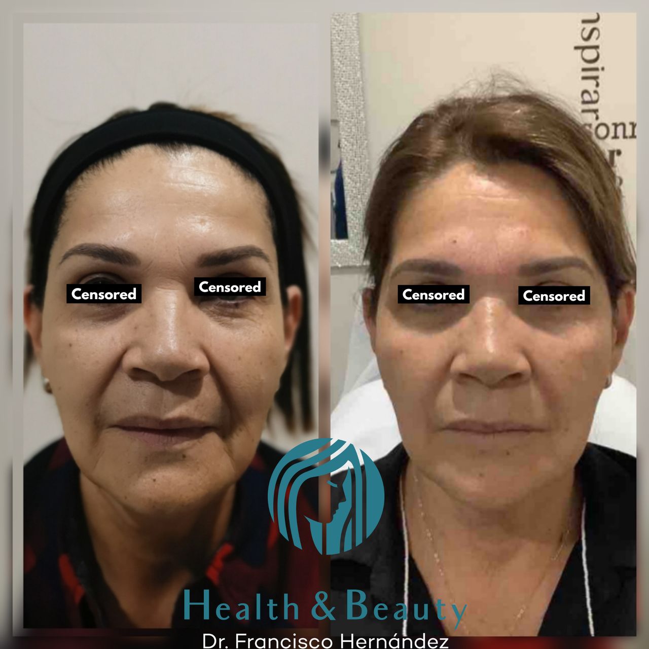 Francisco Hernández Gómez Crespo-175