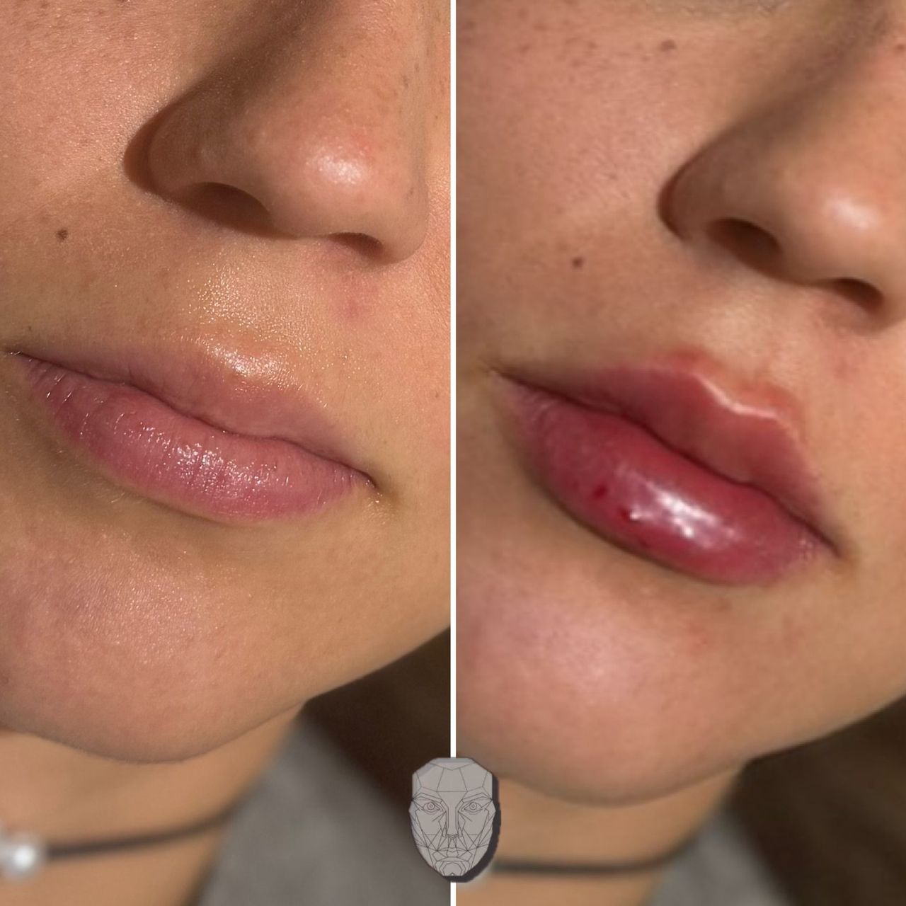 Anuar Hernández Flores-4