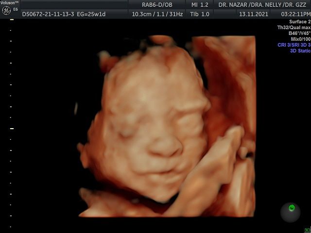 Miguel Angel González Nazar-3