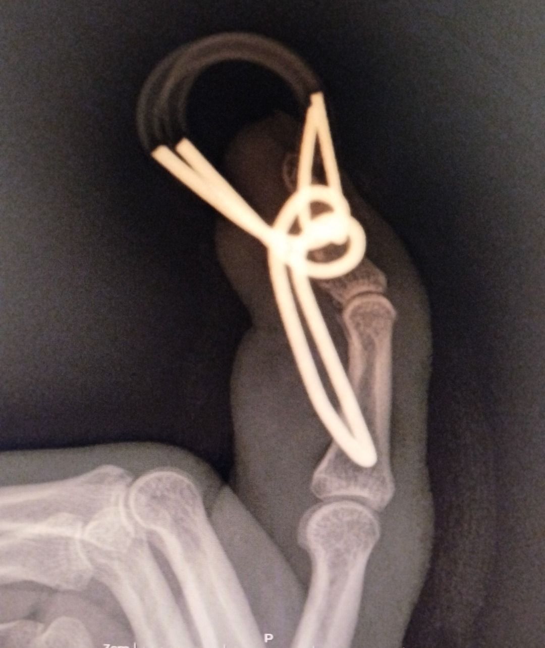 Leonardo Isaac Re-18