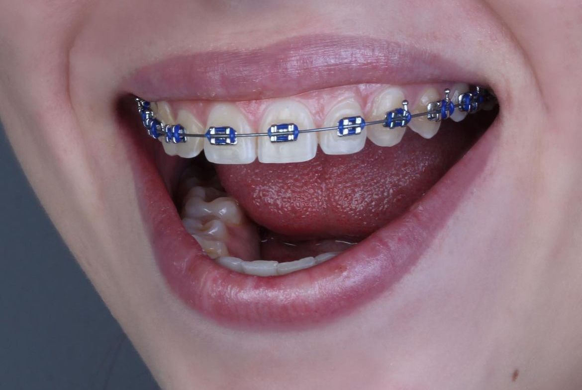 Alondra Valdovinos Orta-2