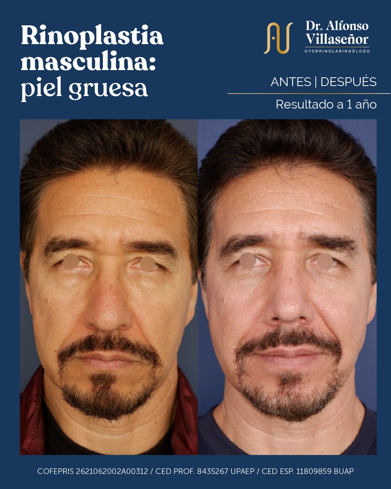 Alfonso Villaseñor Herrero-16