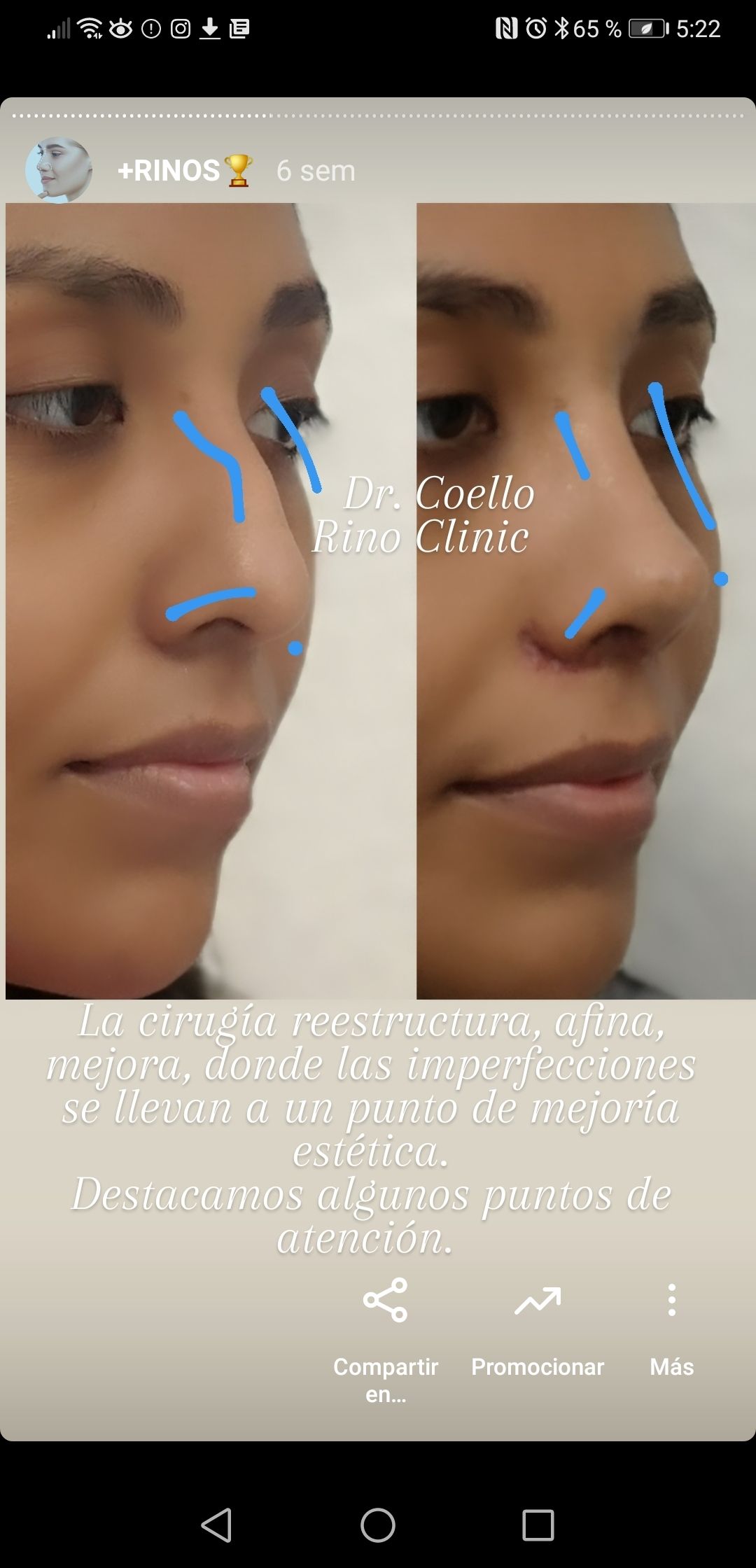 José Enrique Coello Escalante-35