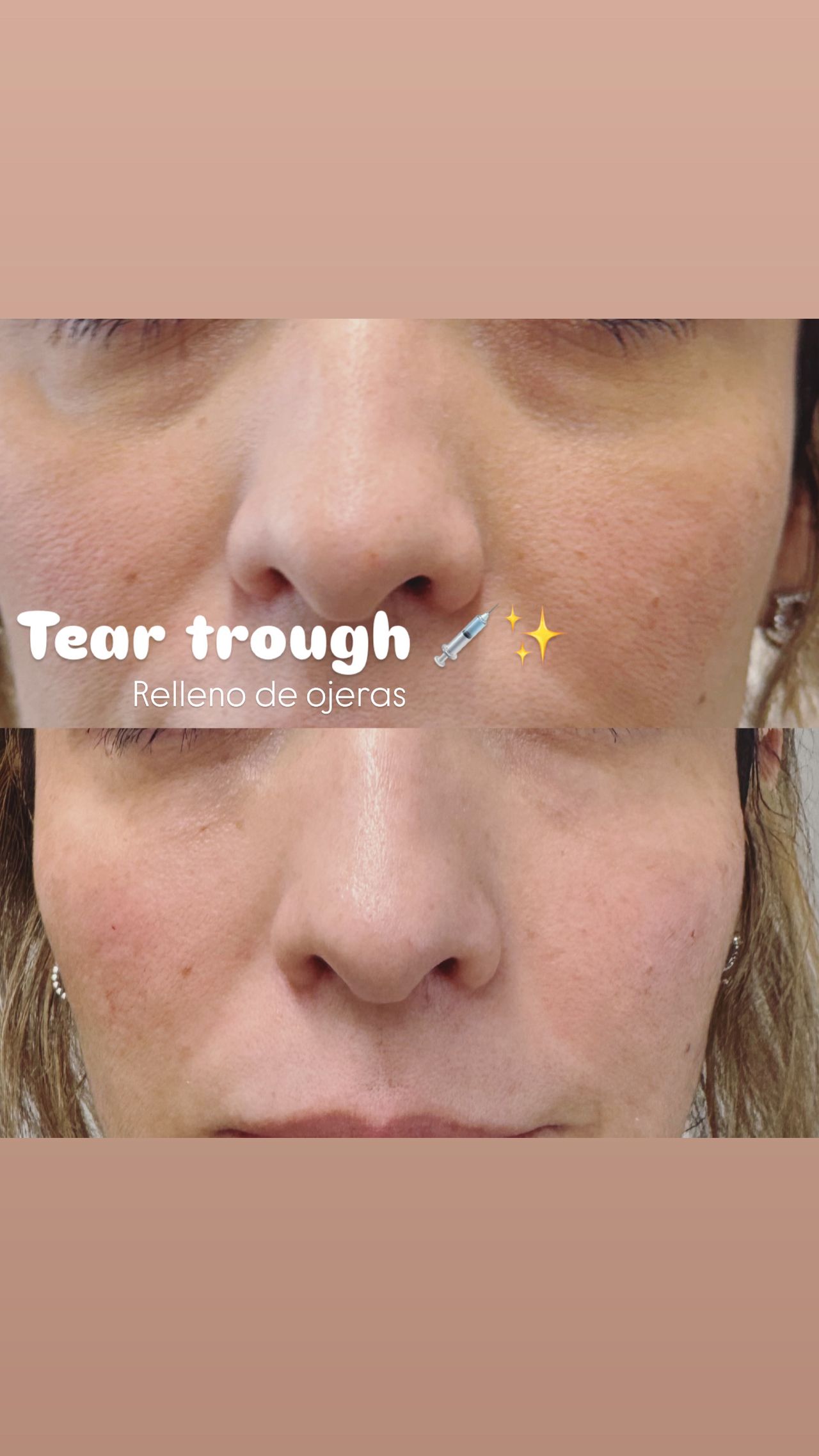 Miguel Angel Aguirre-11