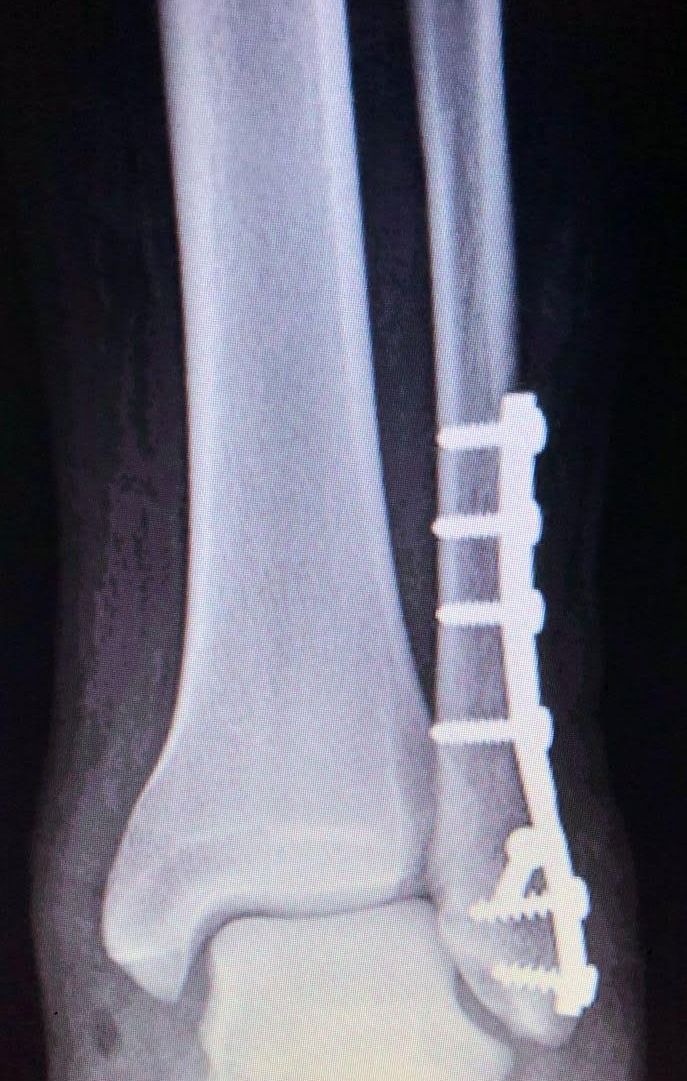 Rubén Rodriguez Acosta-4