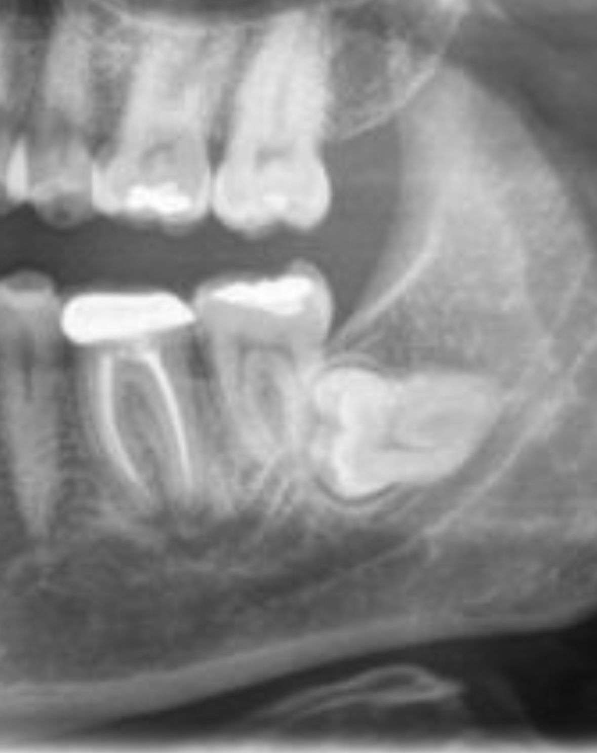 Erendalhi Rocha Mesta-5