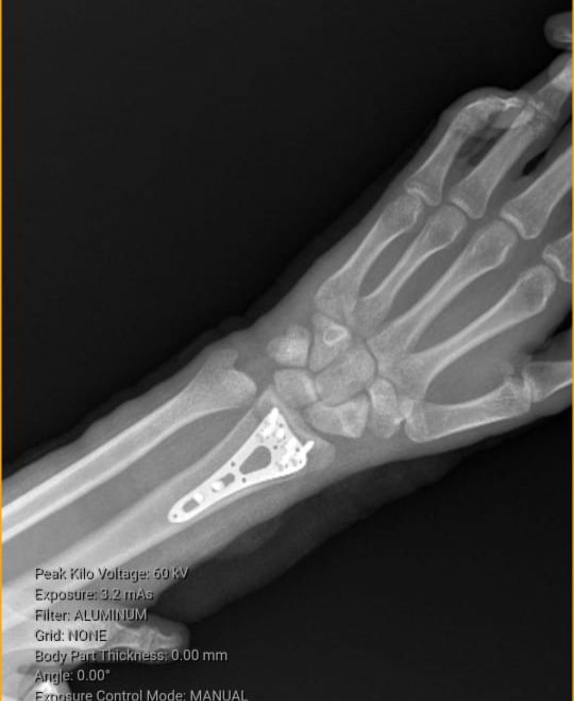 Cristian Ernesto Murillo Medina-2