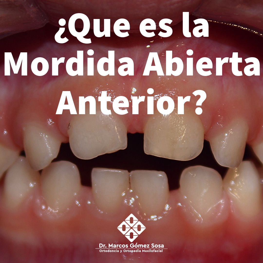 Marcos Gómez Sosa-42