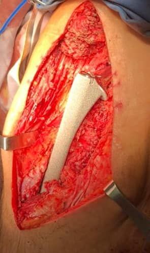 Juan Carlos Flores Raya-20