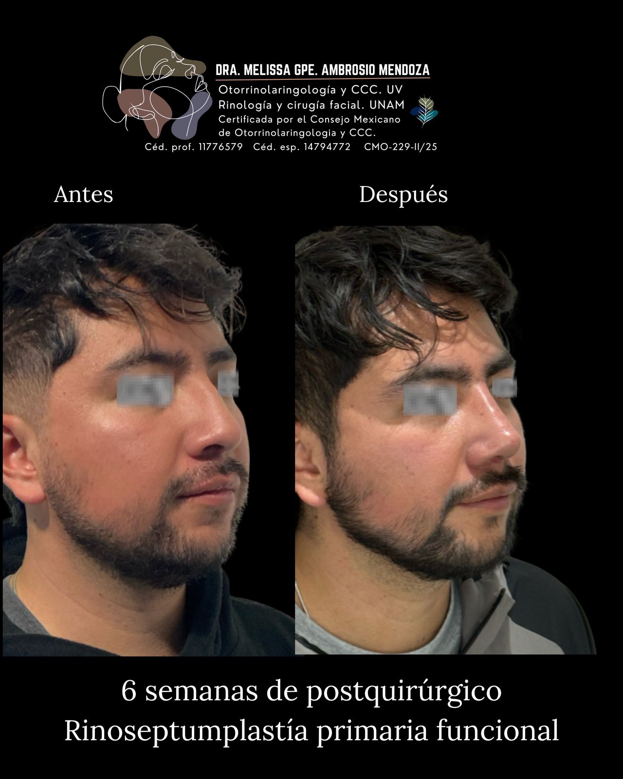 Melissa Guadalupe Ambrosio Mendoza-9