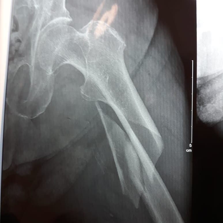 Carlos Humberto Vera Torres-17