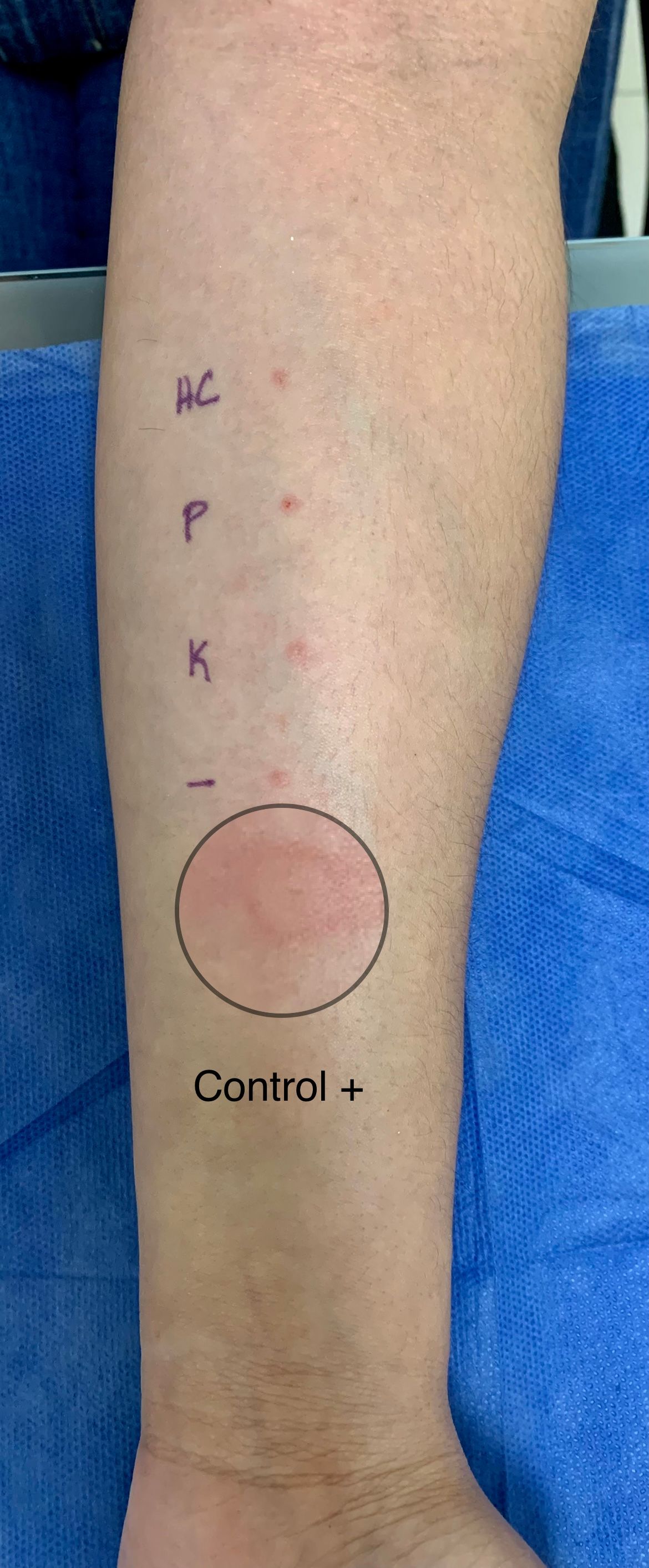 Arturo Gaspar López-7