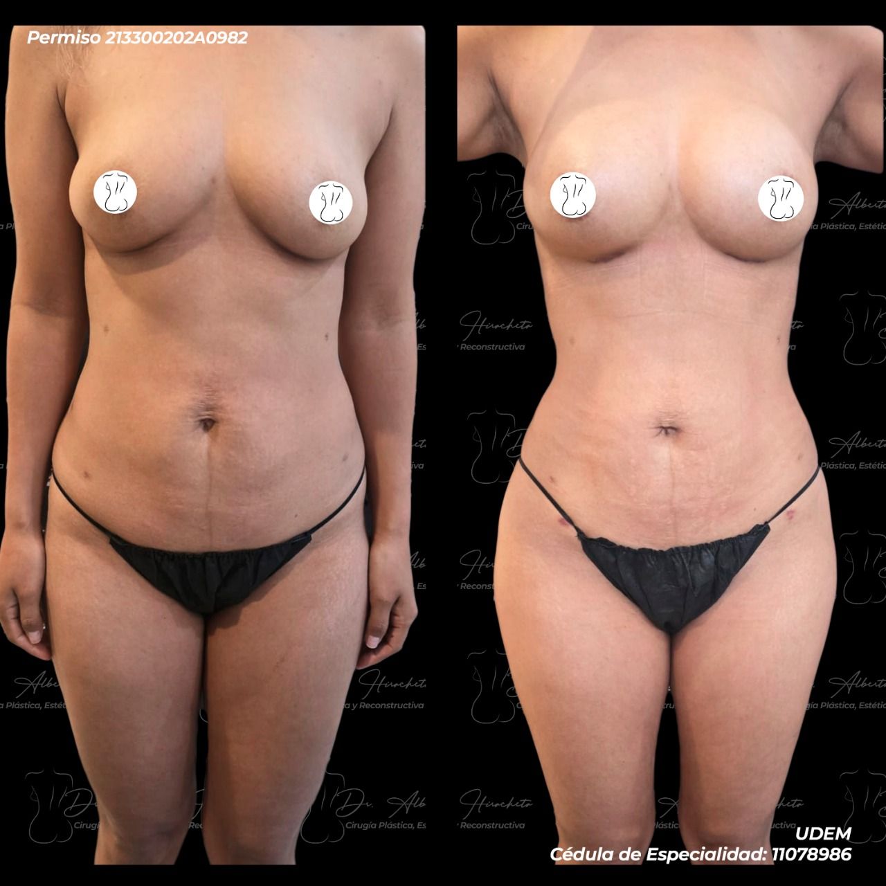 Alberto Hiracheta Torres-28