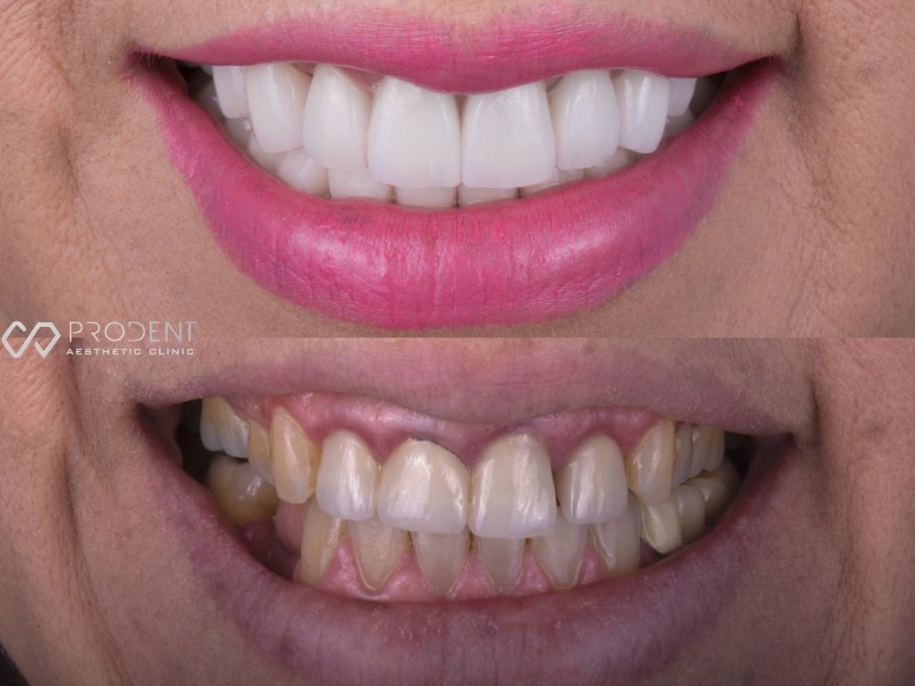 Ulises Pérez Murillo-57