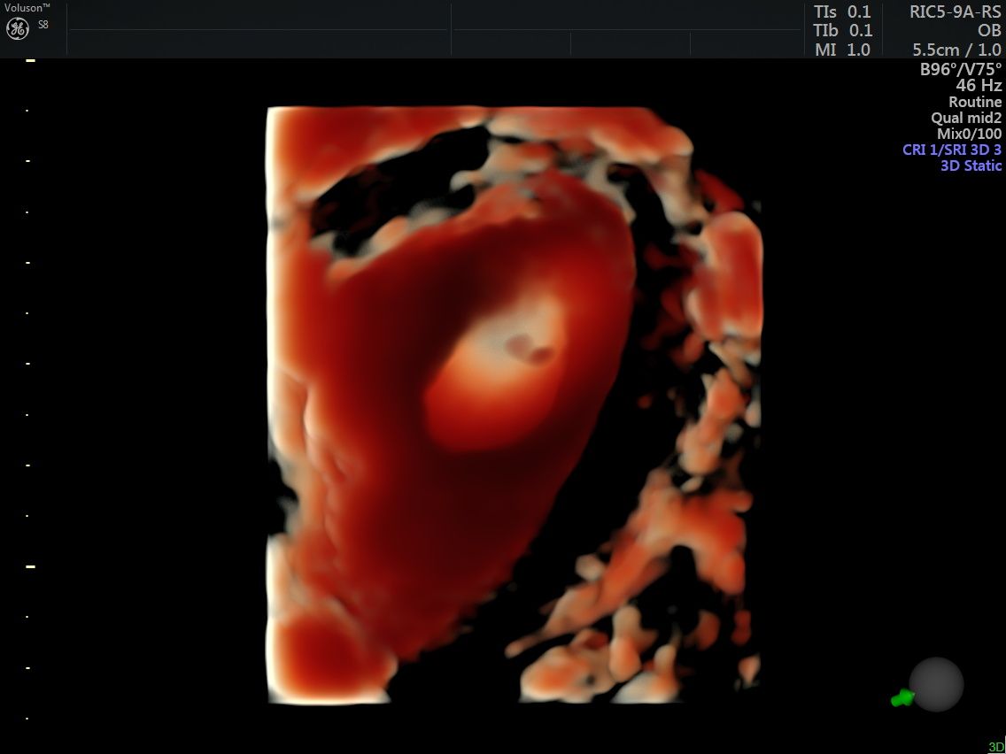 Griselda Reyes Torres-73