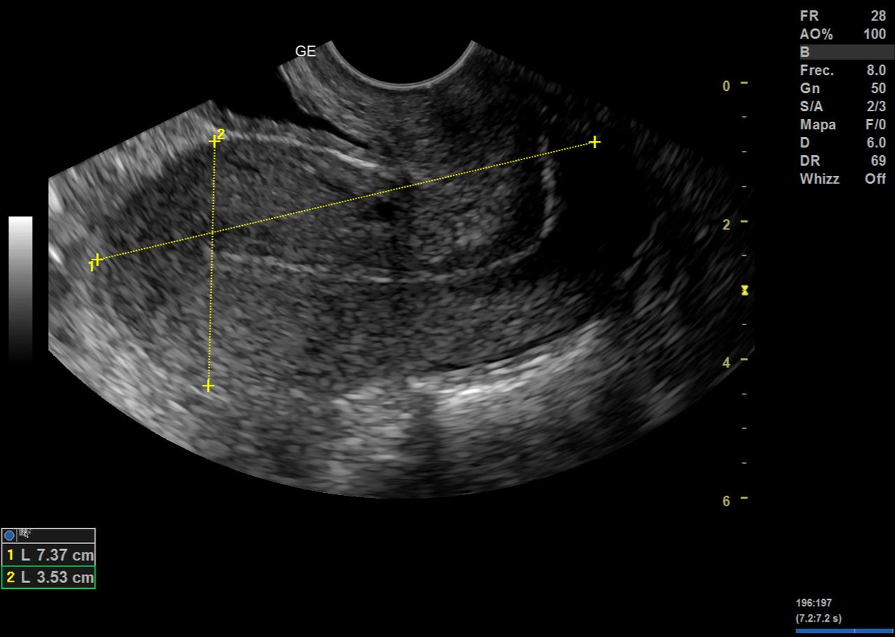 Graciela Elizabeth De La Torre Alvarez-9