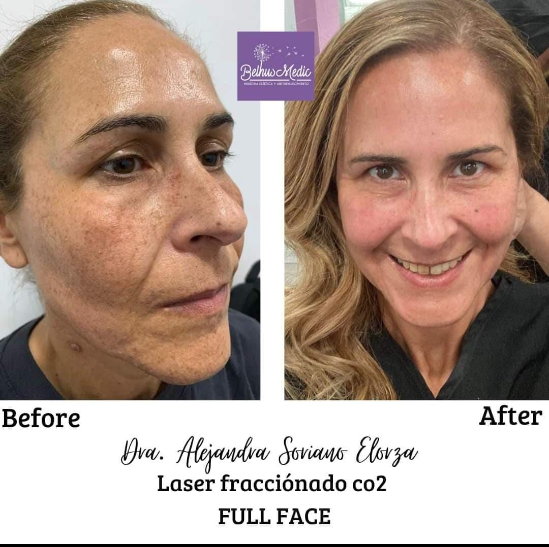 Alejandra Soriano Elorza-28