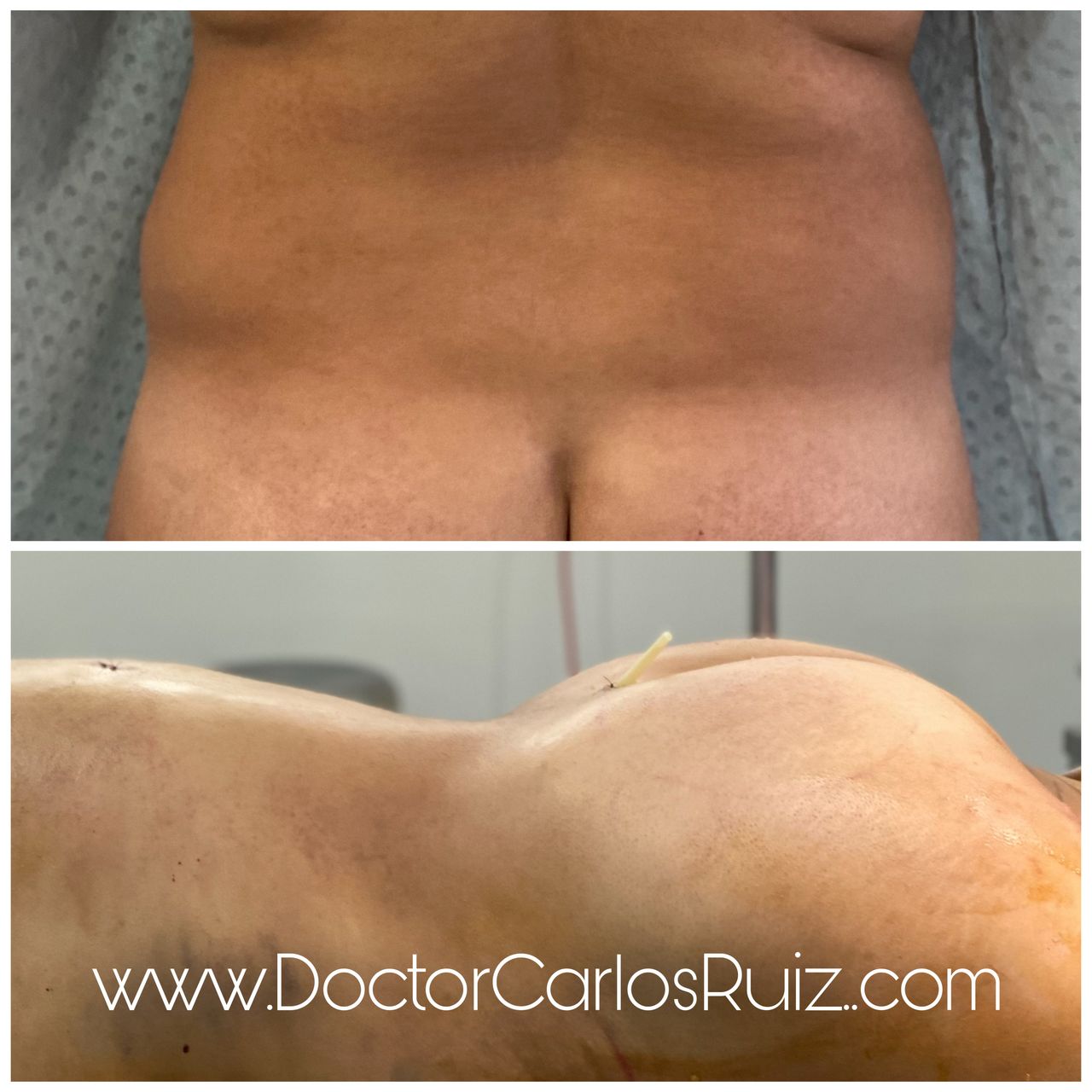 Carlos Alberto Ruiz Zepeda-4