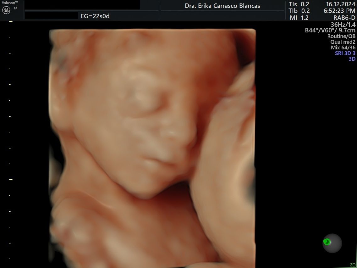 Erika Ruth Carrasco Blancas-12