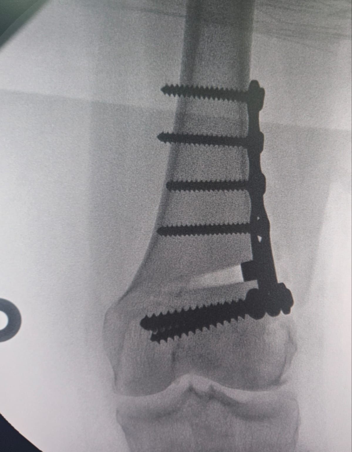 Marcotulio Pérez Valtierra-15