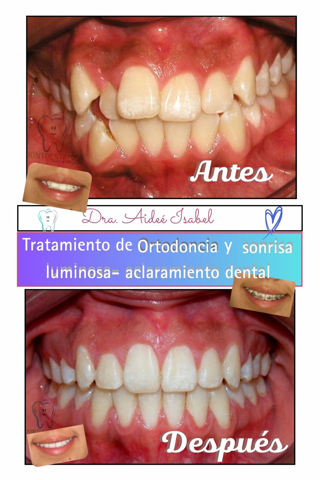Aidee Isabel Agamez Pertuz-1
