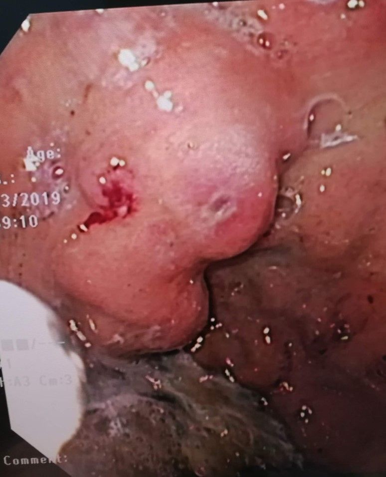 Andy Gabriel Rivera Flores-6