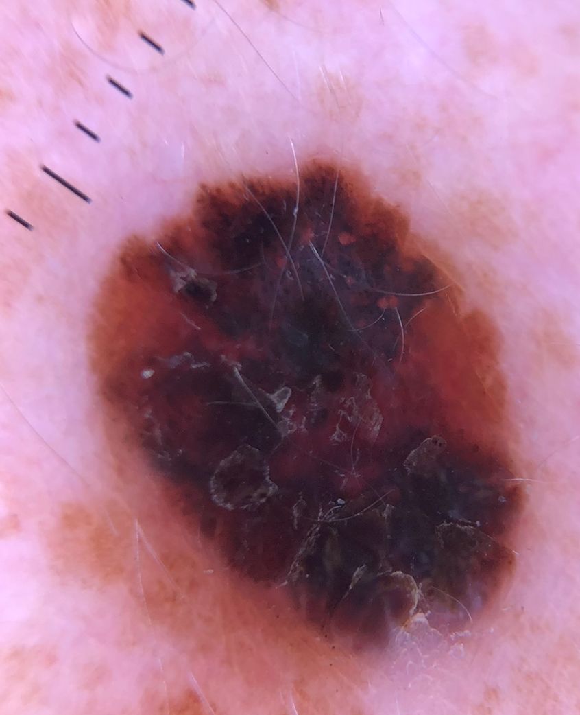 Lauro Francisco Varela Coronado-12