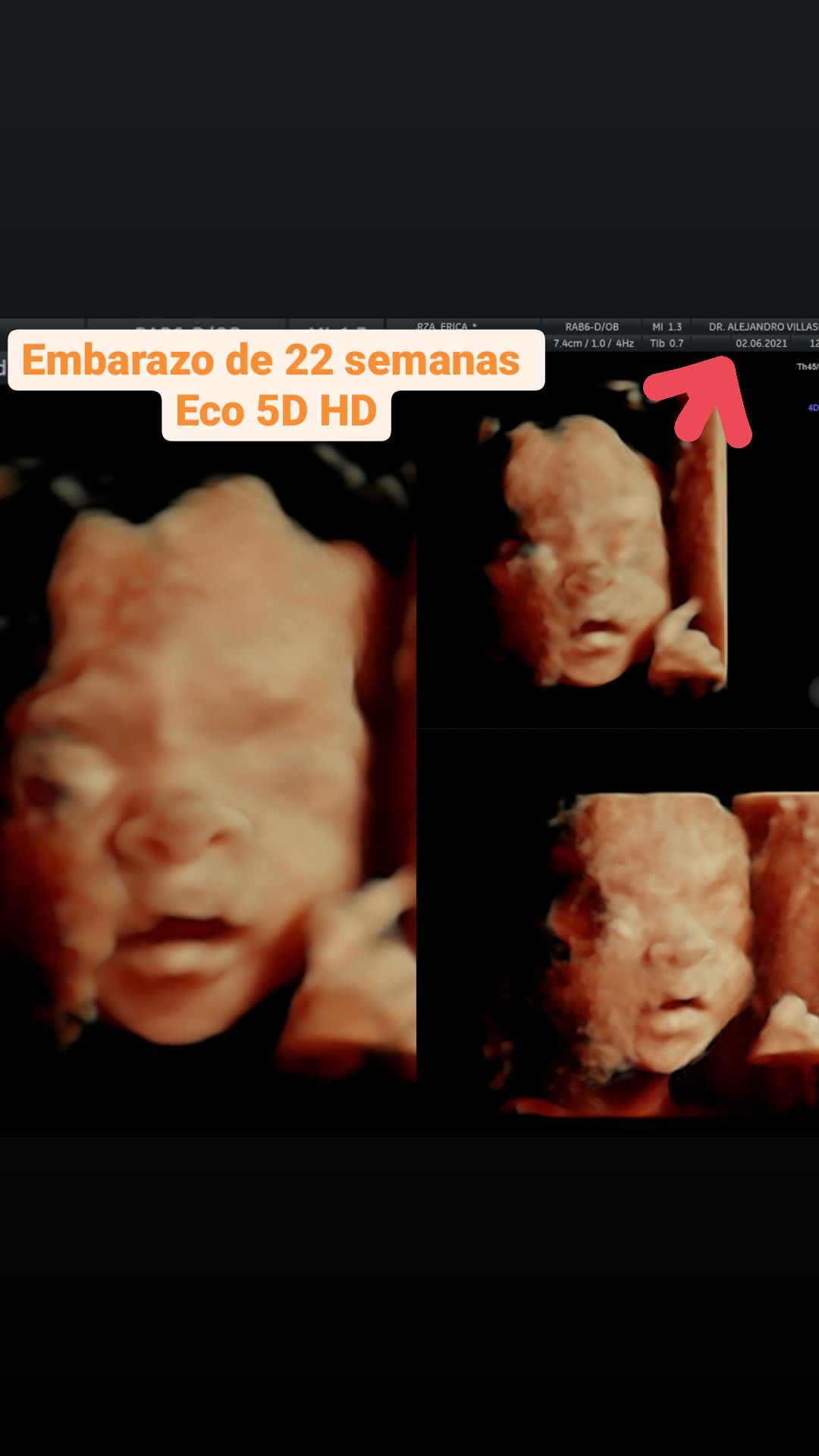 Alejandro Villaseñor Gonzalez-0