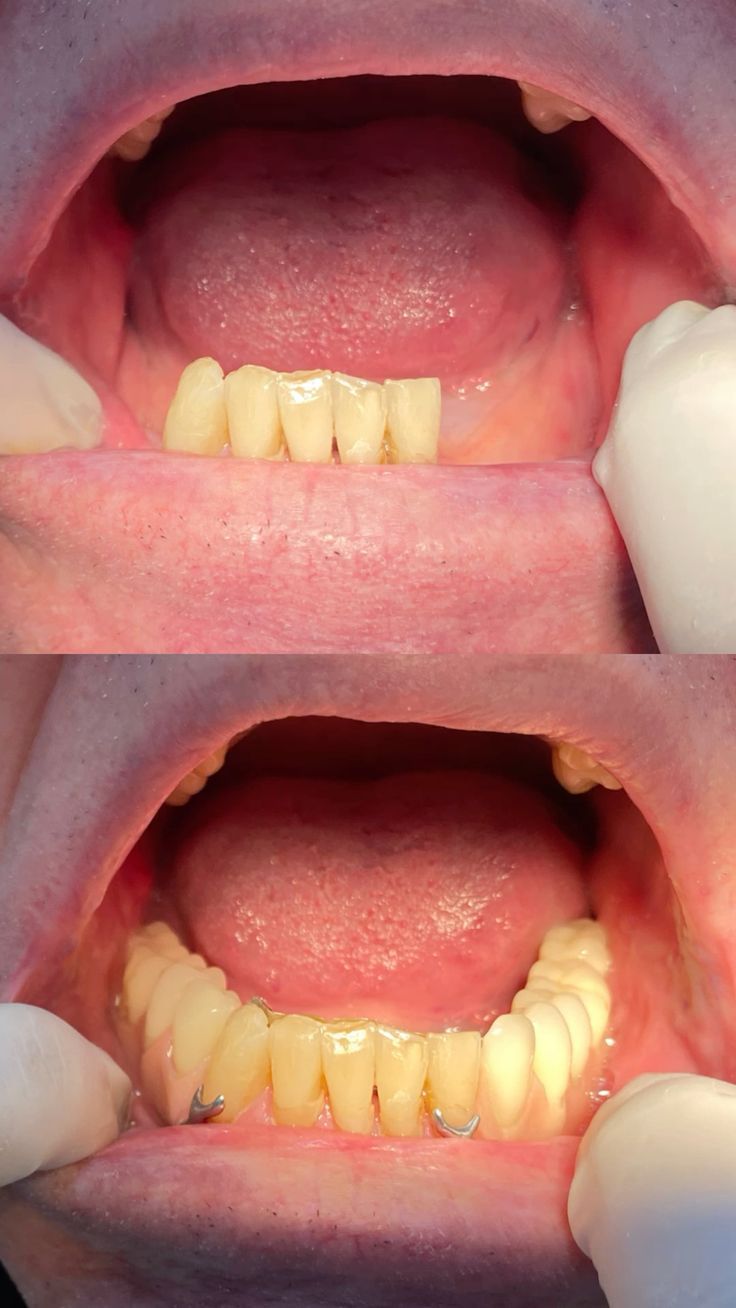 Gloria Haydee Castillo Castellanos-15