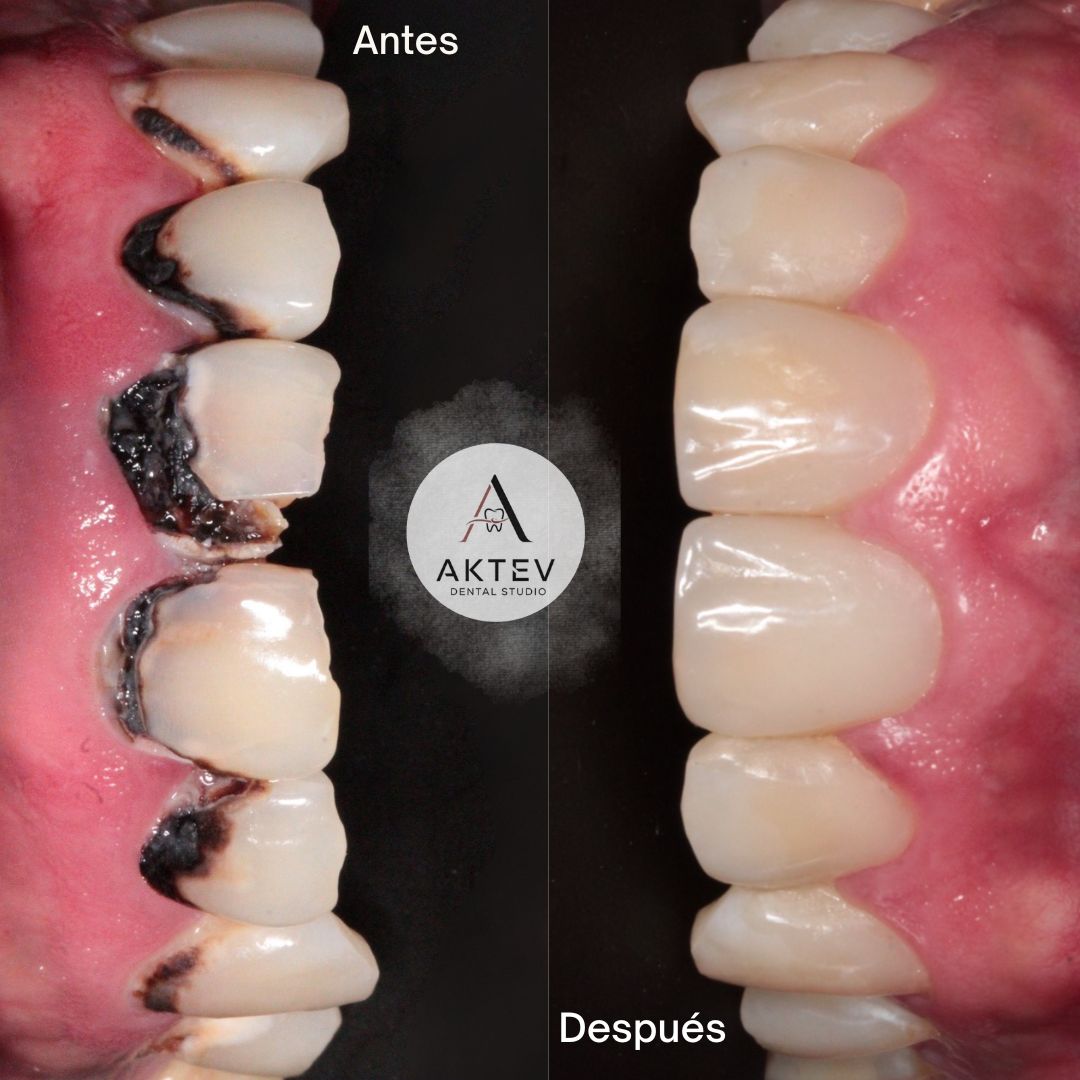 Ana Karen Tenorio Vargas-0