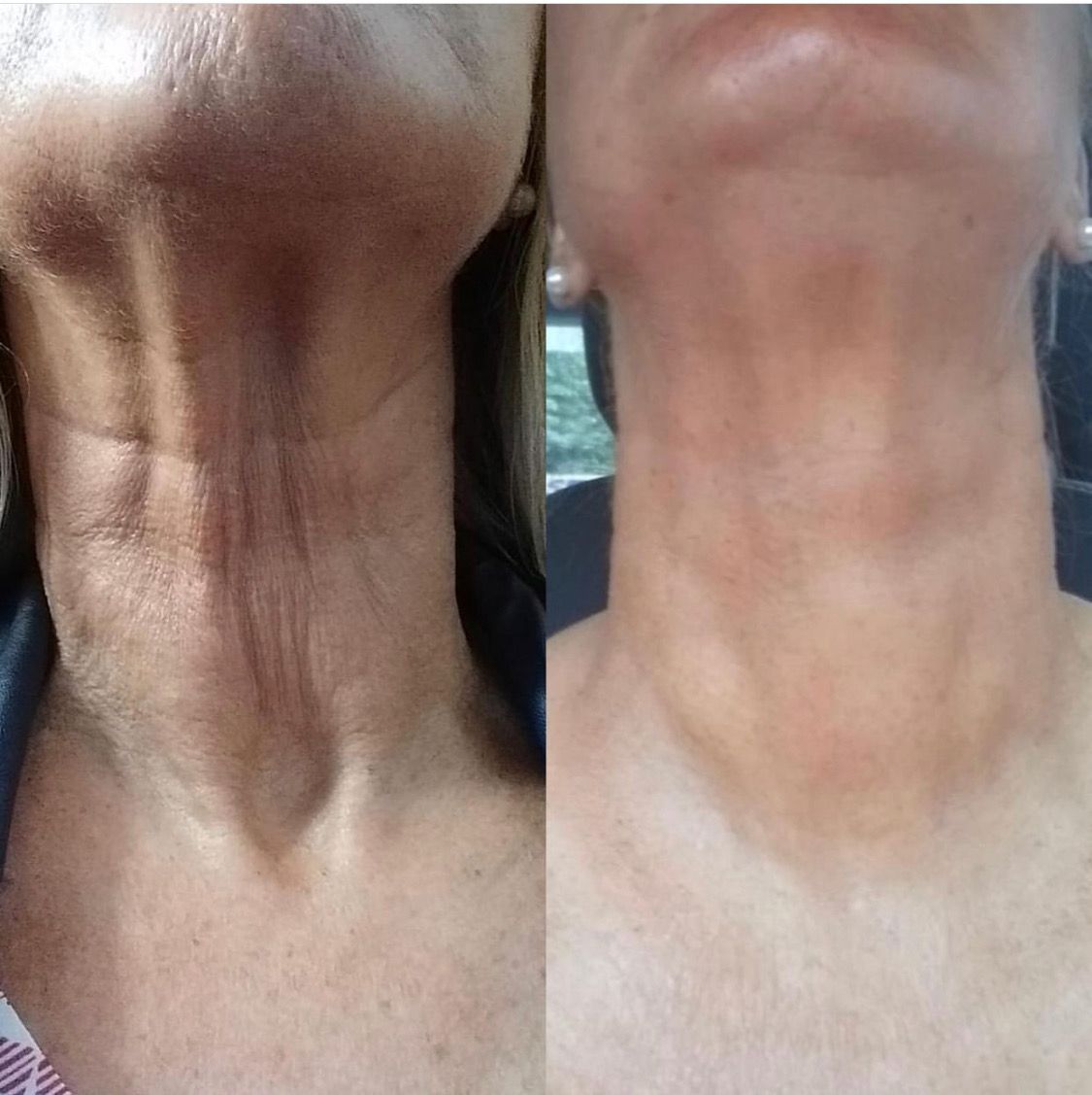 Francisco Hernández Gómez Crespo-169