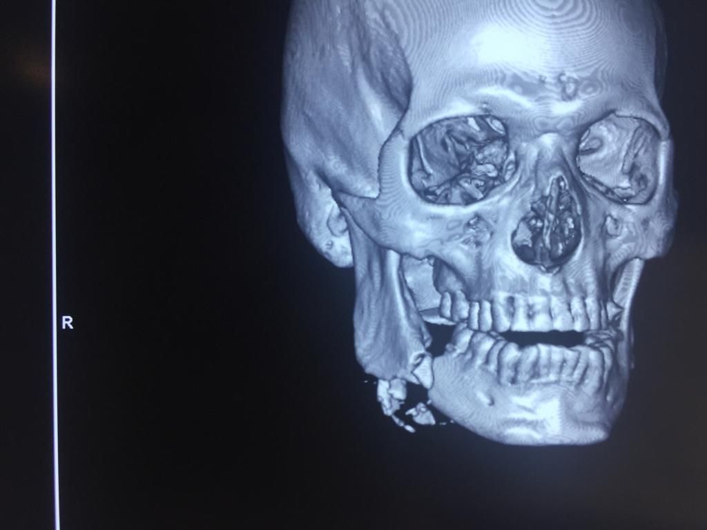 Miguel Tapia Ruiz-23