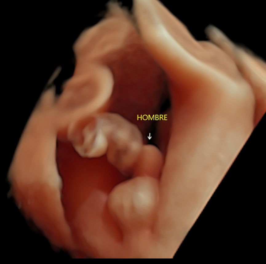 Gustavo Gómez Sánchez-4