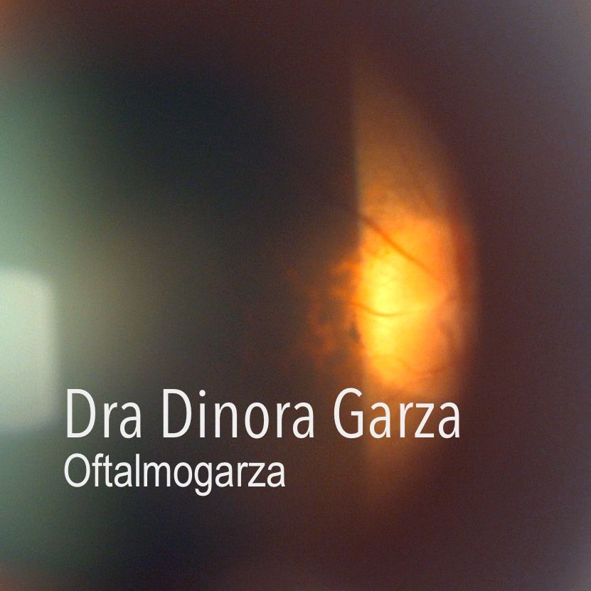 Dinora Garza Leal-37