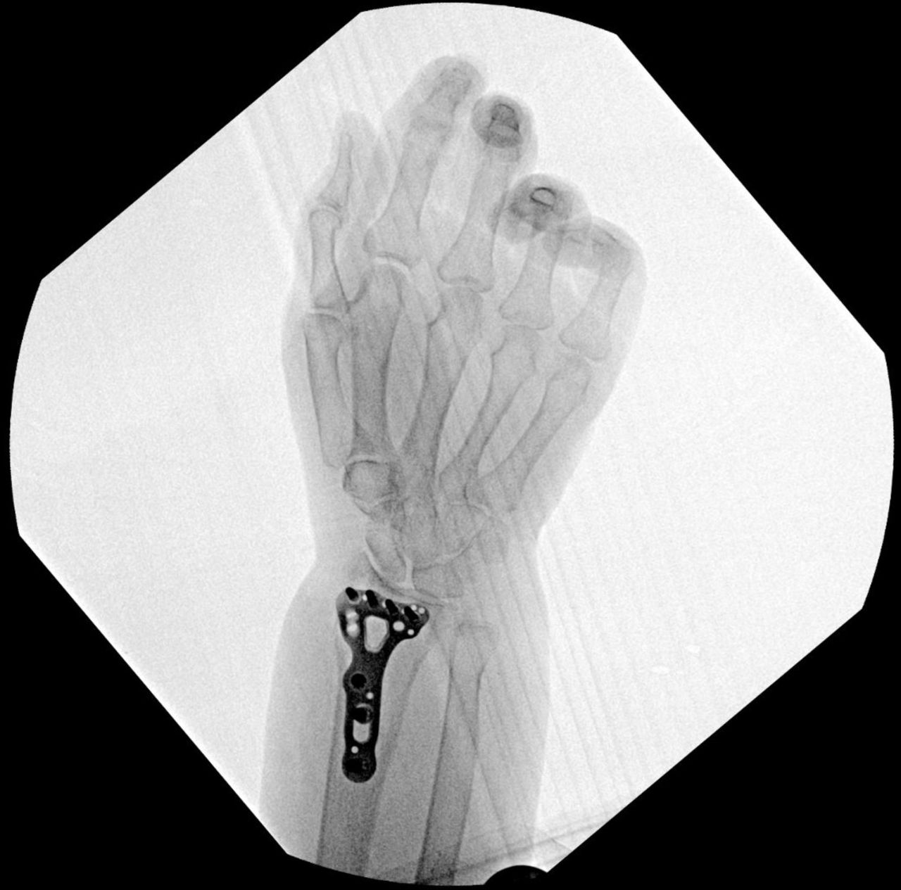 Bardo Grimaldo Hurtado-14