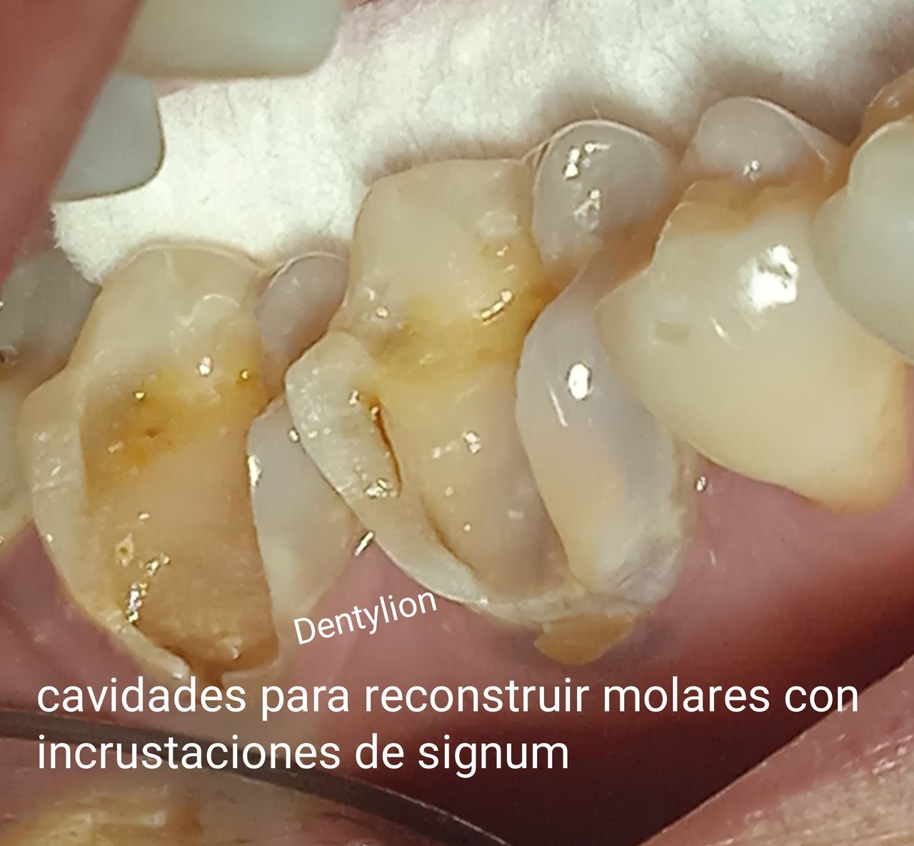 Jessica De La Barrera Valladolid-24