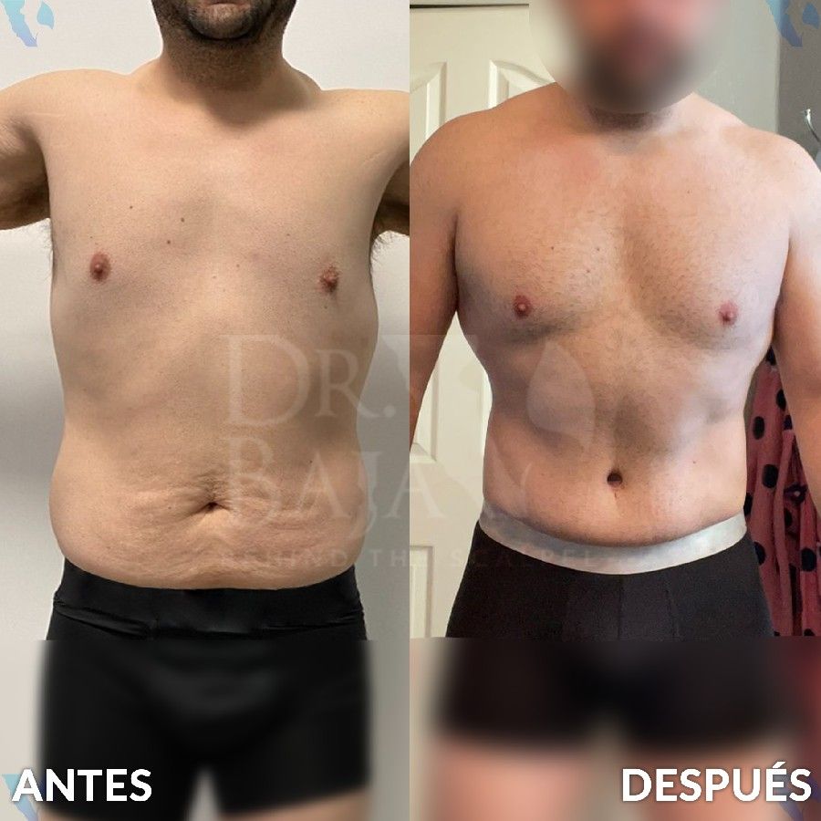 Renato Rodríguez Hirales-45