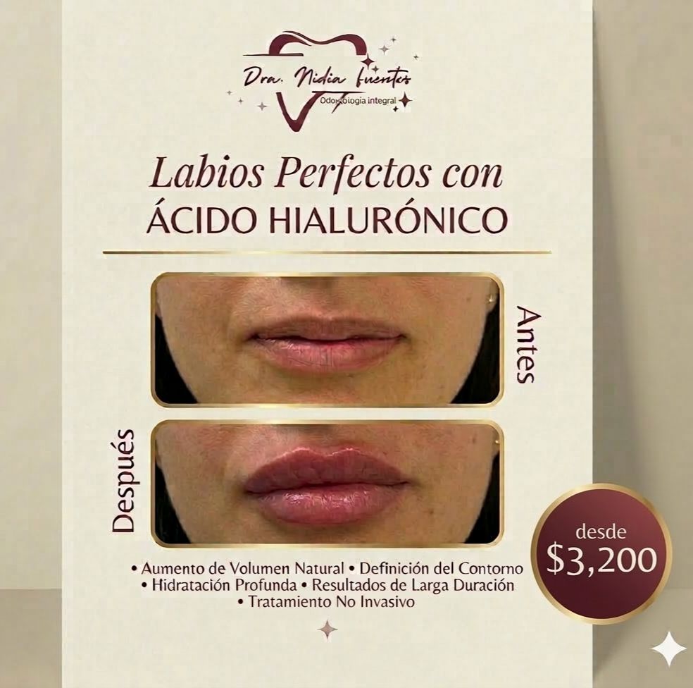 Nidia  Fuentes Aguilar-4