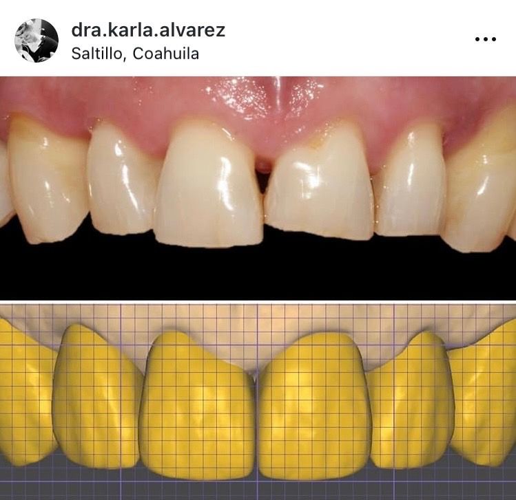 Karla Alvarez Treviño-6