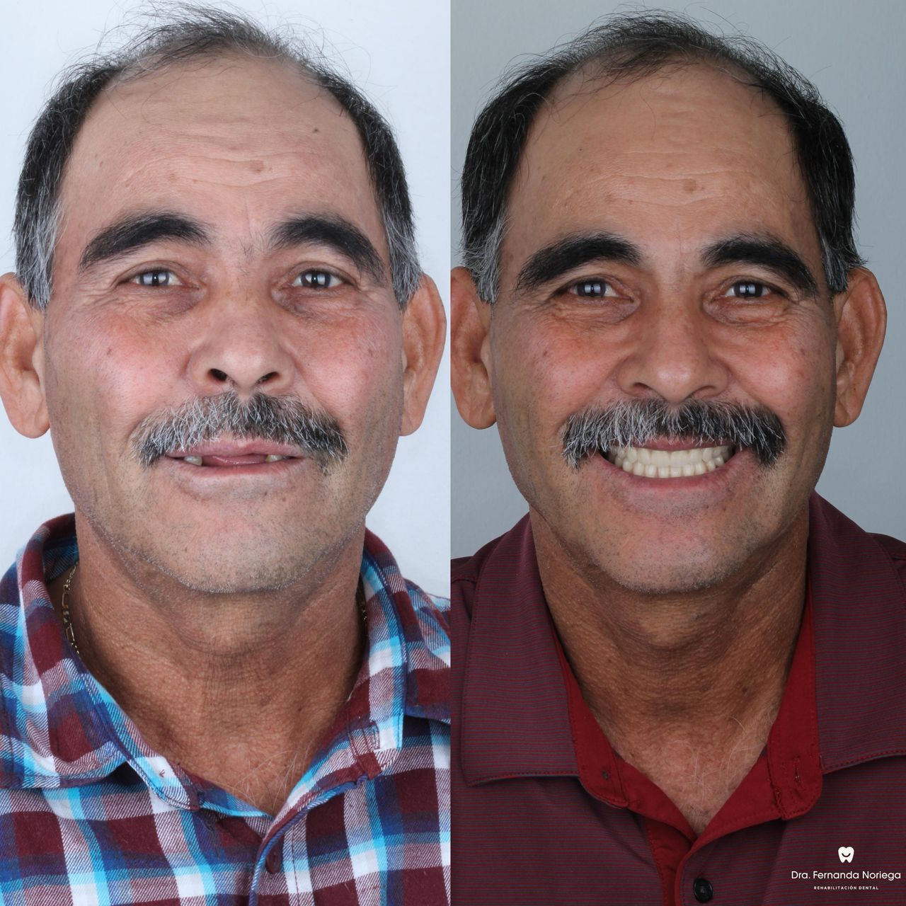 Fernanda Noriega Limón-10