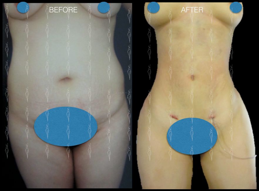 Rubén Nieto Balcázar-1