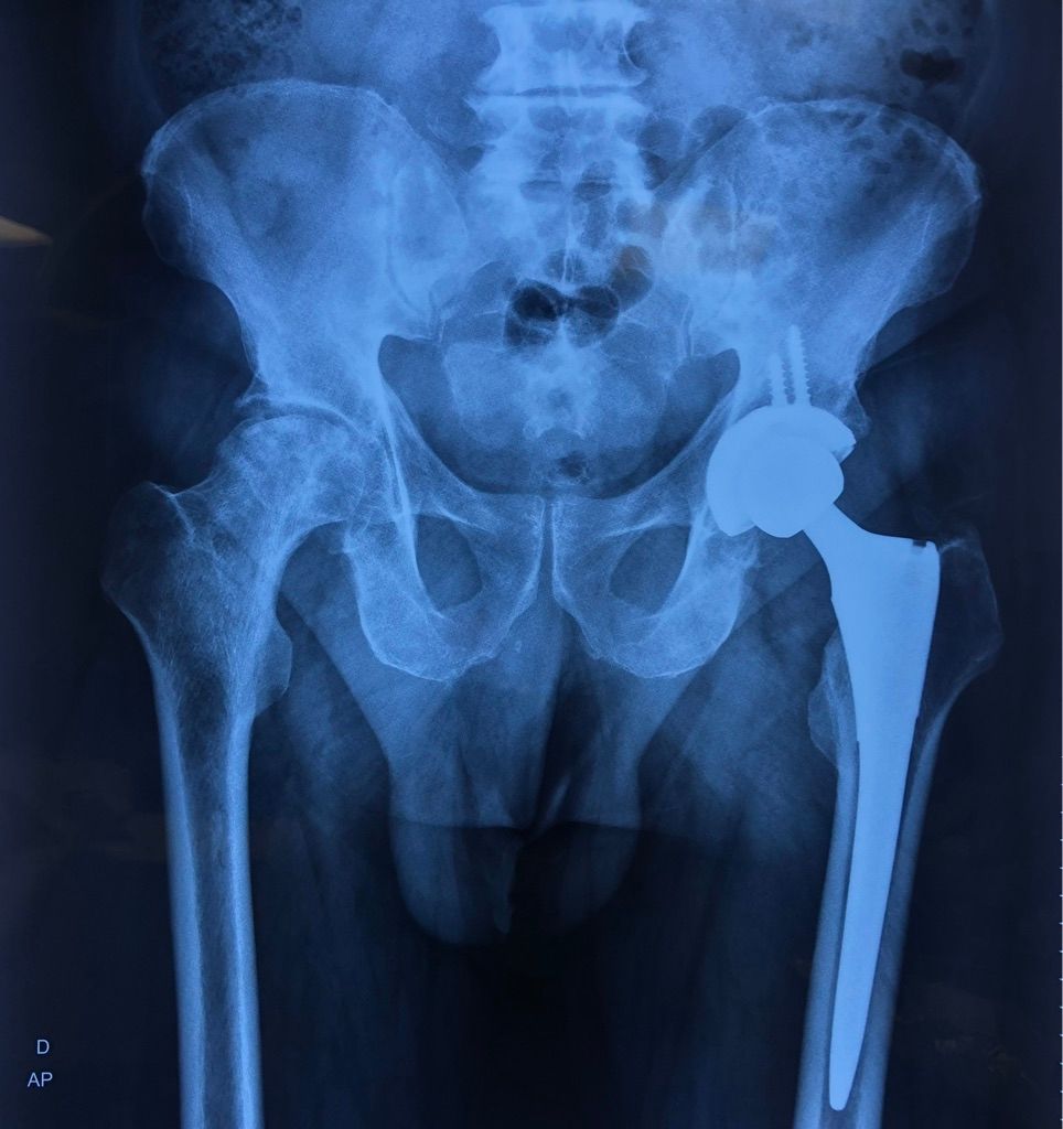 Gisela Cleto Zepeda-93